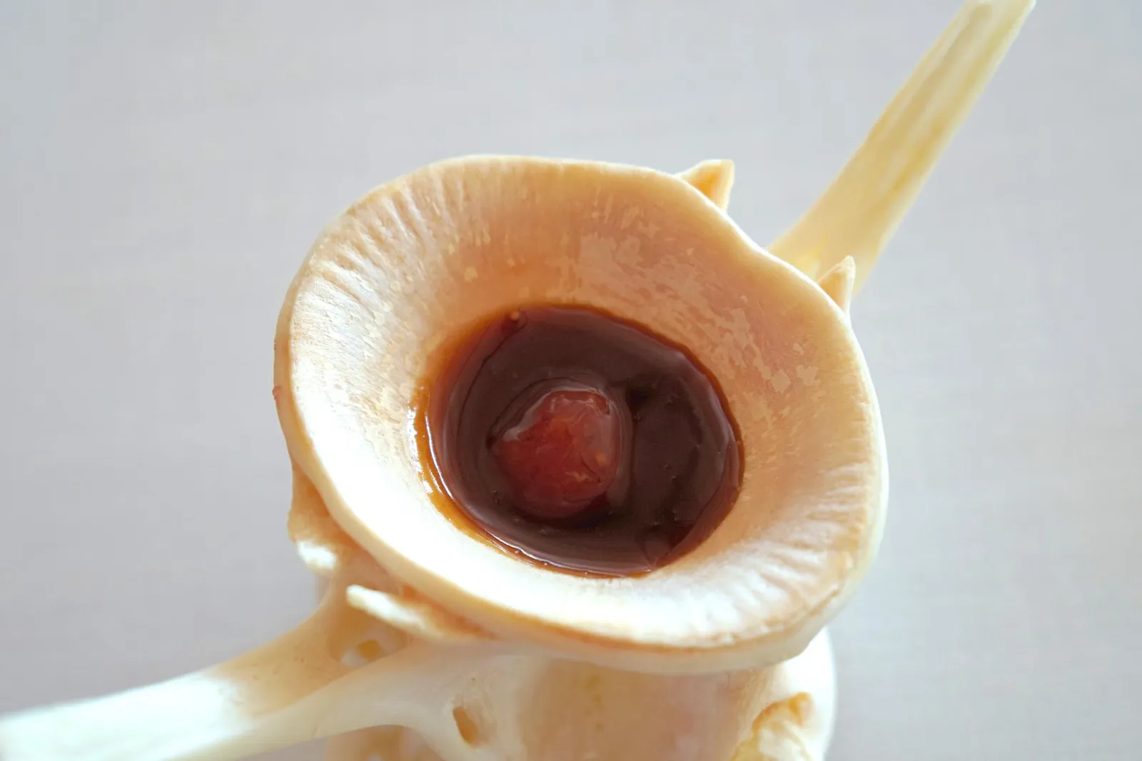 "Tuna ball" จานถัดมาคือ Albóndiga de atún rojo หรือทูน่าบอล ปลาทูน่าสดจากแหล่งจับทูน่าระดับโลกอย่าง Almadraba ในเมือง Cádiz ทางตอนใต้ของประเทศสเปนซึ่งมีจุดเด่นคือวิธีการจับปลาทูน่าแบบดั้งเดิมเรียกว่า Almadraba style ที่ใช้ต่อเนื่องกันมาตั้งเเต่ยุคโรมัน ทางร้านนำปลาทูน่าสดๆไปสับจนละเอียด ราดด้วยน้ำซอสรสชาติเข้มข้นทำจากทูน่า ขิง และเลมอน เสิร์ฟมาในกระดูกปลาทูน่าของจริง ซอสเลมอนกับขิงเสริมรสชาติกันได้อย่างดี เนื้อสัมผัสเหนียวข้น หอมขึ้นจมูก สุดยอดมากๆ (18/20)